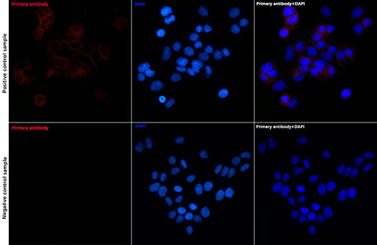 E-Cadherin Rabbit mAb