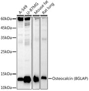 Osteocalcin (BGLAP) Rabbit mAb