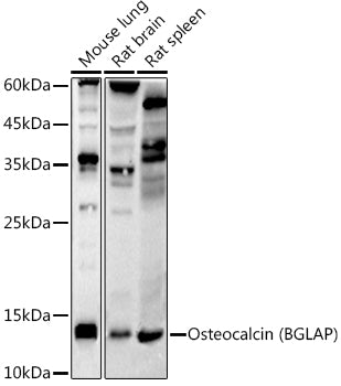 Osteocalcin (BGLAP) Rabbit mAb