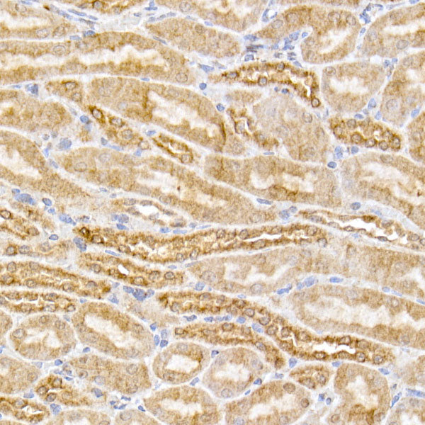 [KO Validated] SIRT3 Rabbit mAb