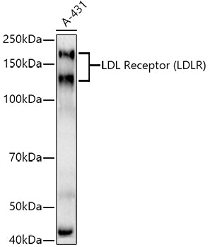LDL Receptor (LDLR) Rabbit mAb