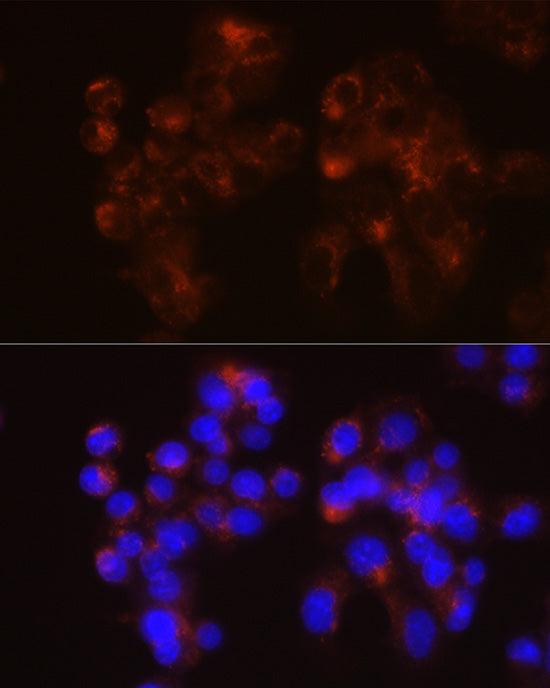LDL Receptor (LDLR) Rabbit mAb