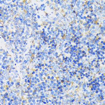 GSK3β Rabbit pAb
