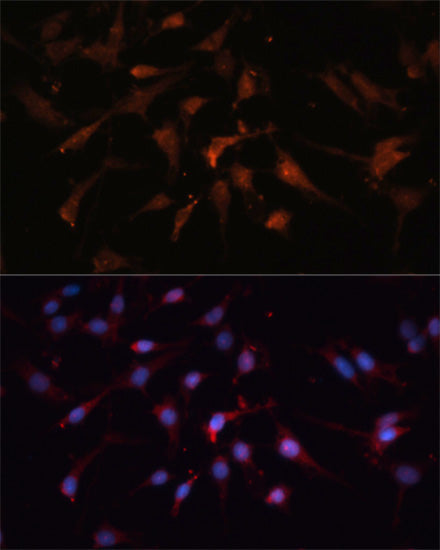 GSK3β Rabbit pAb