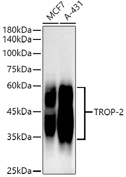 TROP-2 Rabbit mAb