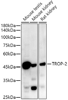 TROP-2 Rabbit mAb