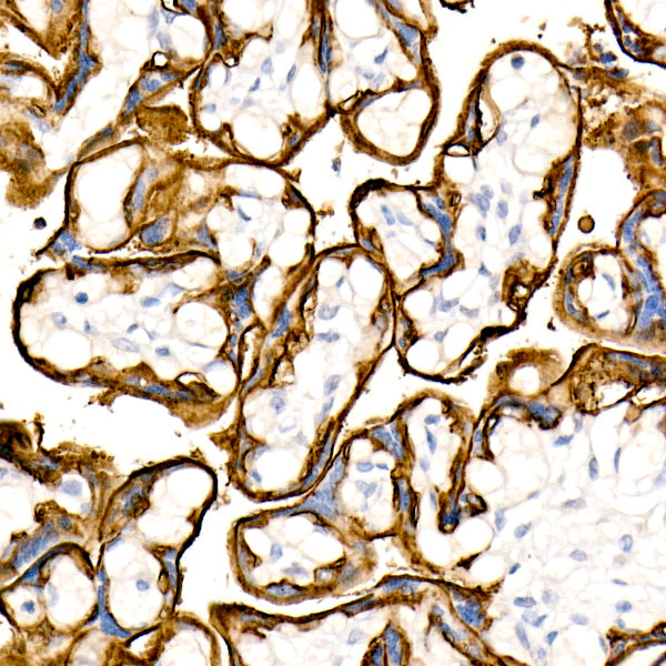 TROP-2 Rabbit mAb