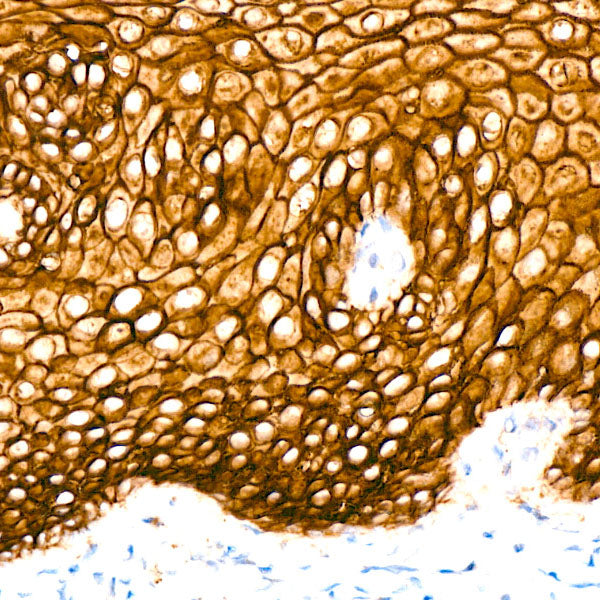 TROP-2 Rabbit mAb