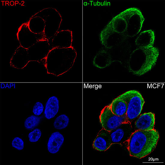 TROP-2 Rabbit mAb