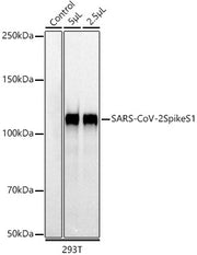 SARS-CoV-2 Spike S1 Rabbit mAb