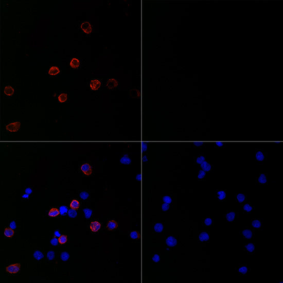 SARS-CoV-2 Spike S1 Rabbit mAb