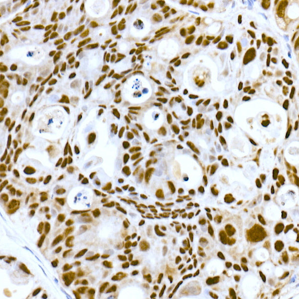 DNA-PKcs Rabbit mAb