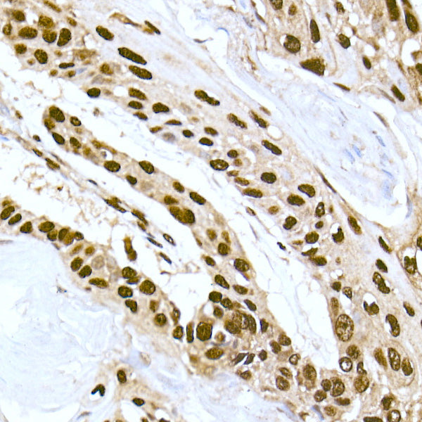 DNA-PKcs Rabbit mAb