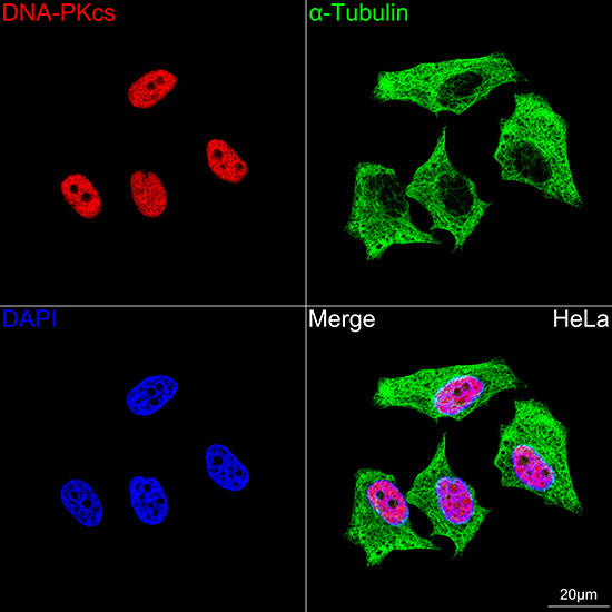 DNA-PKcs Rabbit mAb