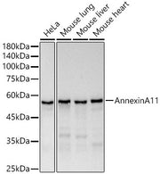 Annexin A11  Rabbit mAb