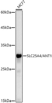 [KO Validated] SLC25A4/ANT1 Rabbit mAb
