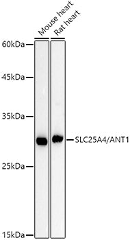 [KO Validated] SLC25A4/ANT1 Rabbit mAb