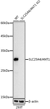 [KO Validated] SLC25A4/ANT1 Rabbit mAb