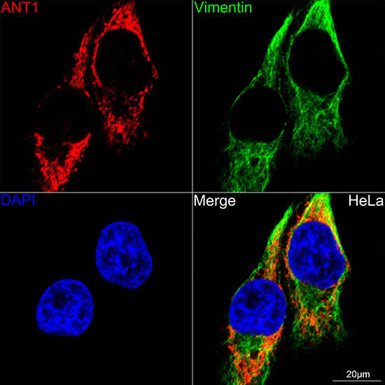 [KO Validated] SLC25A4/ANT1 Rabbit mAb