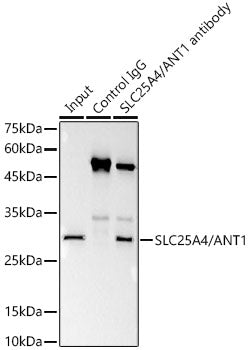 [KO Validated] SLC25A4/ANT1 Rabbit mAb