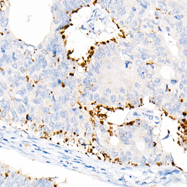 Perilipin-2 Rabbit mAb