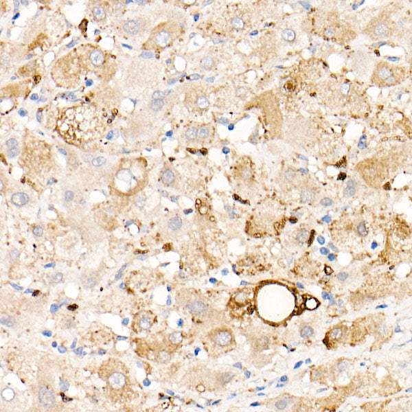 Perilipin-2 Rabbit mAb