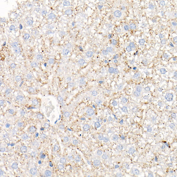 Perilipin-2 Rabbit mAb