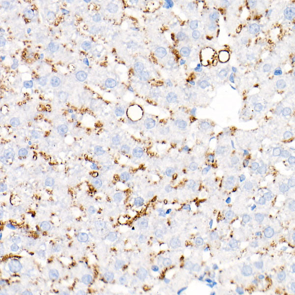 Perilipin-2 Rabbit mAb