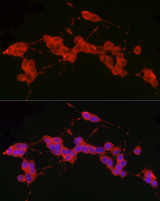 Ret Rabbit mAb
