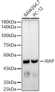 [KO Validated] XIAP Rabbit mAb