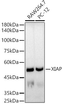 [KO Validated] XIAP Rabbit mAb