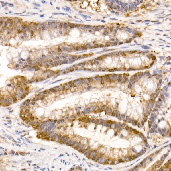 Bag1 Rabbit mAb