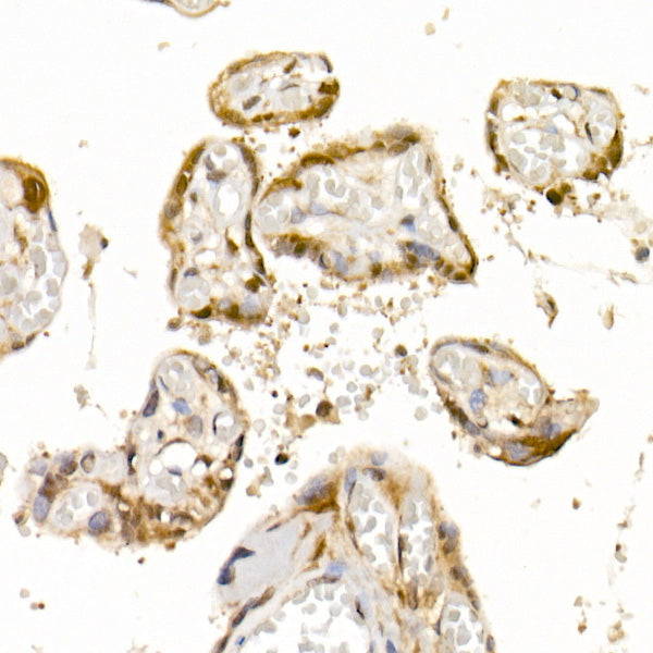 Bag1 Rabbit mAb
