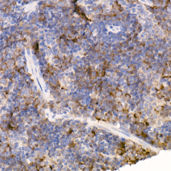 Bag1 Rabbit mAb