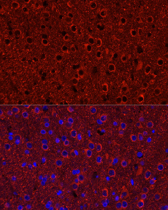 P2Y12 Rabbit mAb