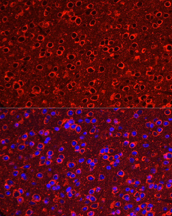 P2Y12 Rabbit mAb