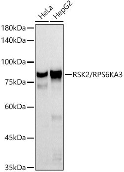 RSK2 / RPS6KA3 Rabbit mAb