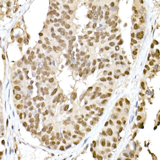 RSK2 / RPS6KA3 Rabbit mAb