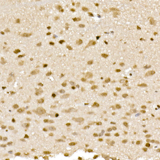 RSK2 / RPS6KA3 Rabbit mAb
