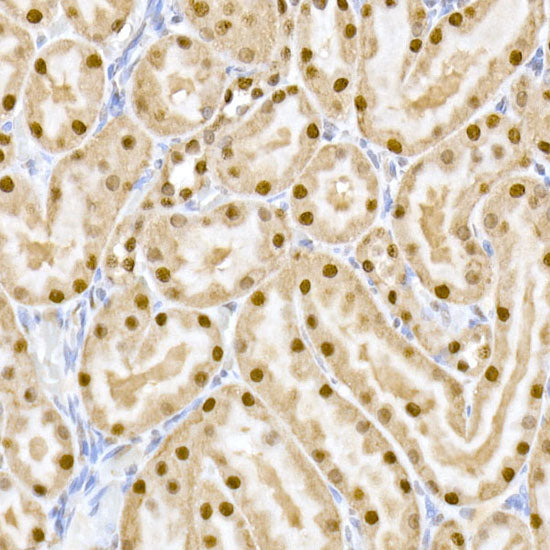 RSK2 / RPS6KA3 Rabbit mAb