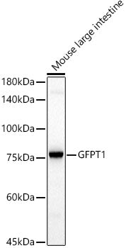GFPT1 Rabbit mAb