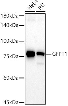 GFPT1 Rabbit mAb