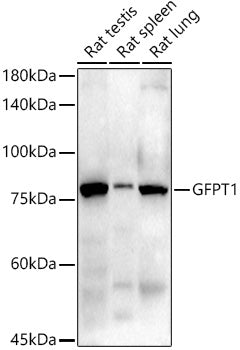 GFPT1 Rabbit mAb