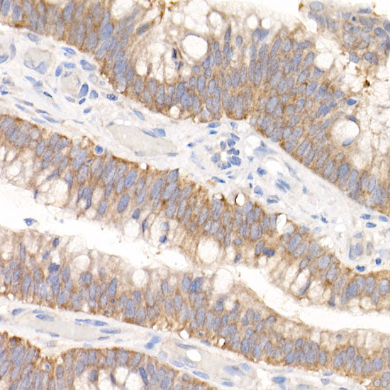 GFPT1 Rabbit mAb