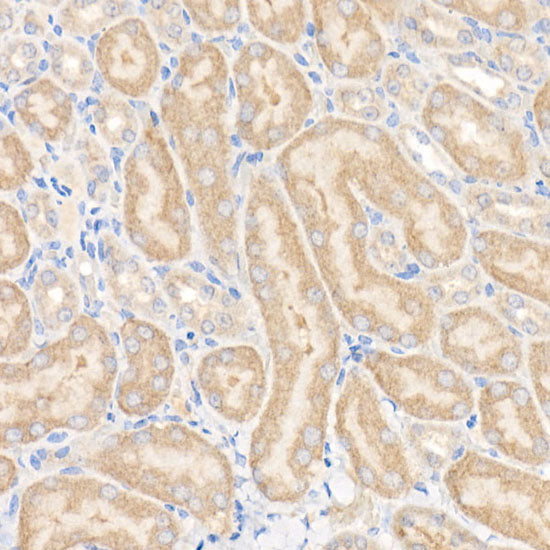 GFPT1 Rabbit mAb