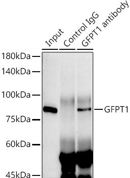 GFPT1 Rabbit mAb