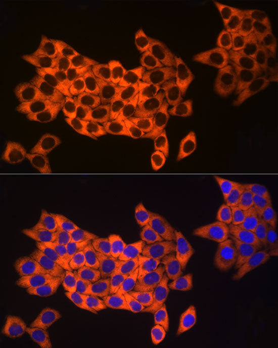 UBA52 Rabbit mAb