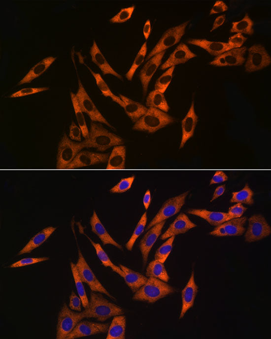 UBA52 Rabbit mAb