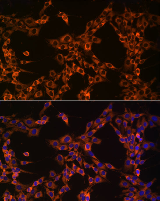 UBA52 Rabbit mAb