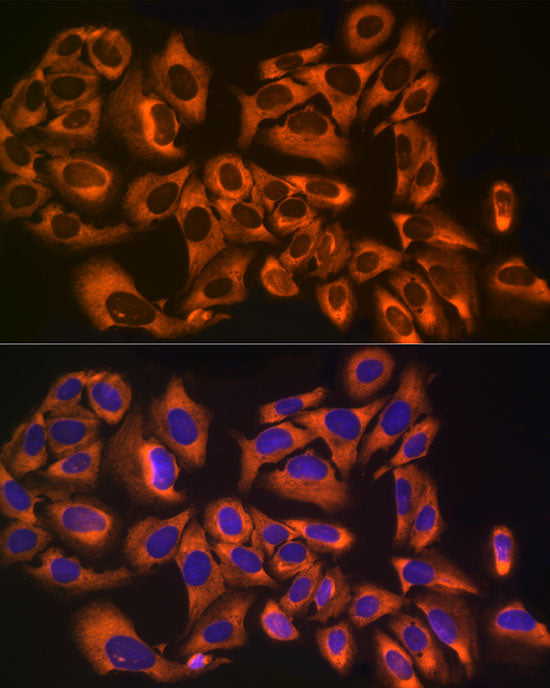 UBA52 Rabbit mAb